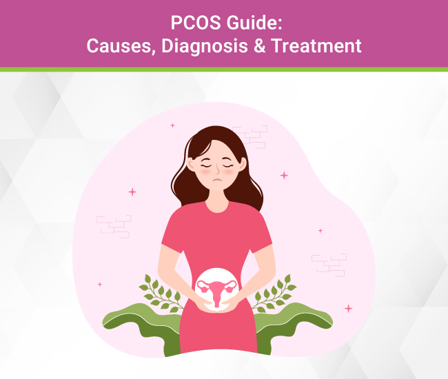PCOS Guide: Causes, Diagnosis & Treatment